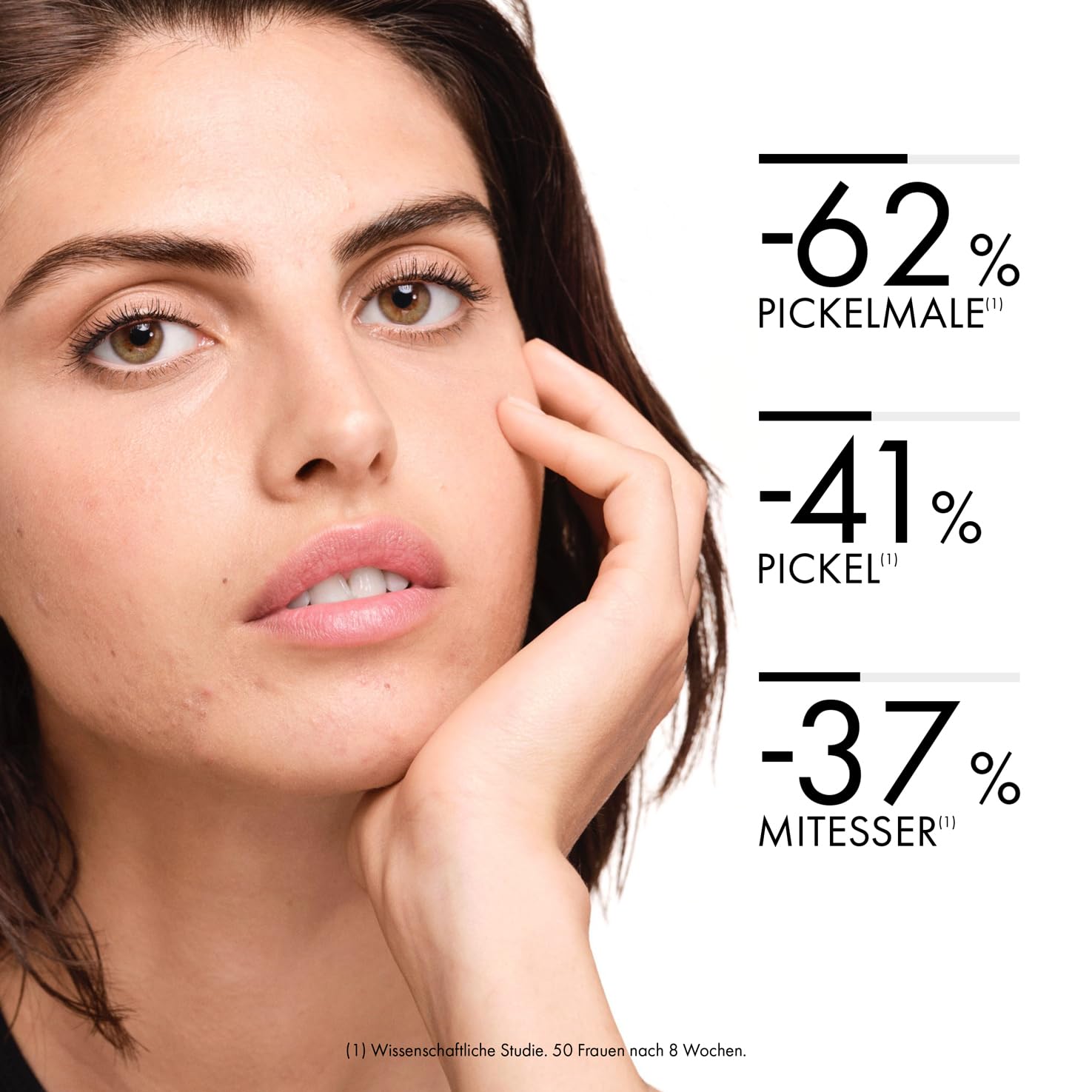 VICHY Sensitive Anti-Unreinheiten-Pflege, Für fettige, zu Akne neigende Haut, Mattierend und Regenerierend, Mit Hyaluron- und Salicylsäure, Normaderm Phytosolution, 50 ml