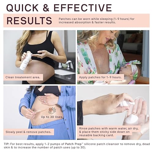 Miniatura 5 de Enrollar la imagen para acercar Dermaclara Kit de parches de silicona para estrías  Cuidado de la piel seguro para el embarazo Enrolle la imagen