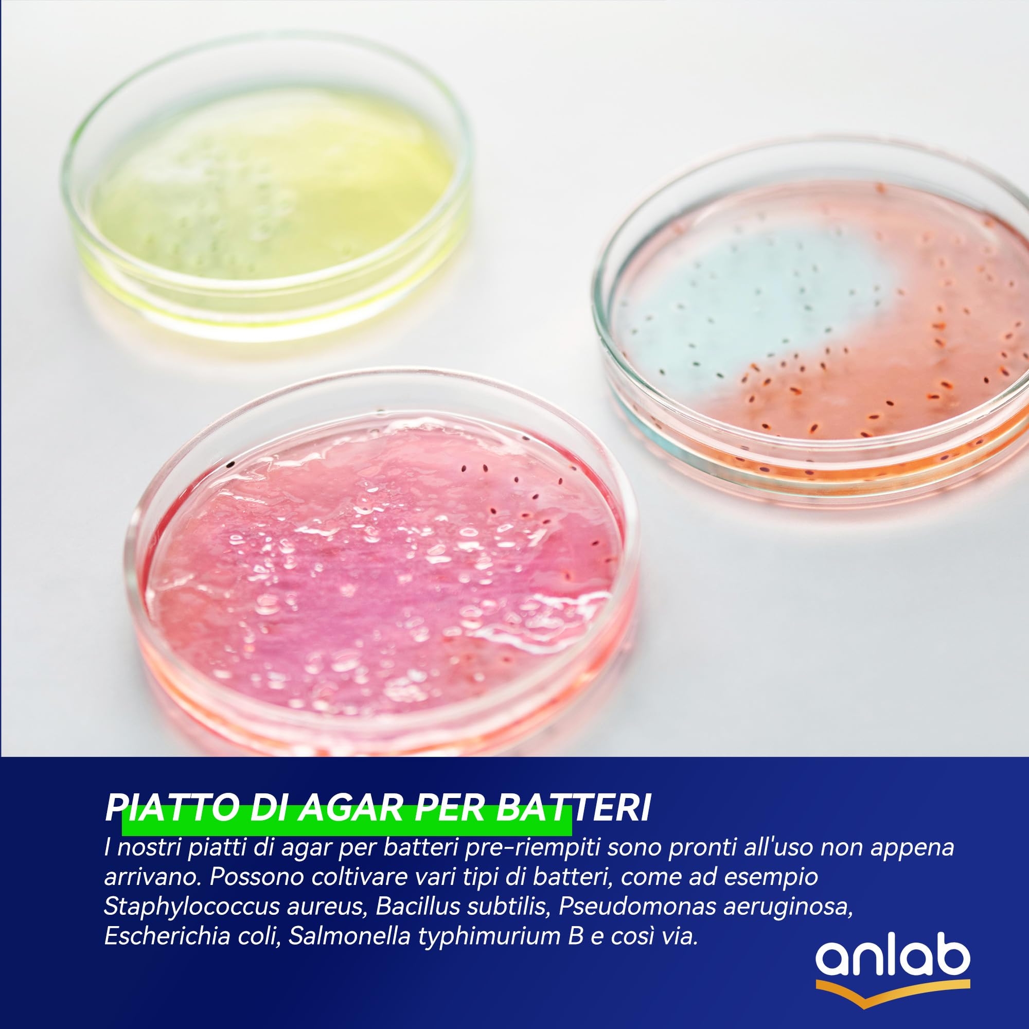 Nutrient Agar Petri Dishes Project Kit | Pre-Poured Agar Plates and Cotton Swabs for Experiments | Bacteria Kit - Sealed Separately (30)