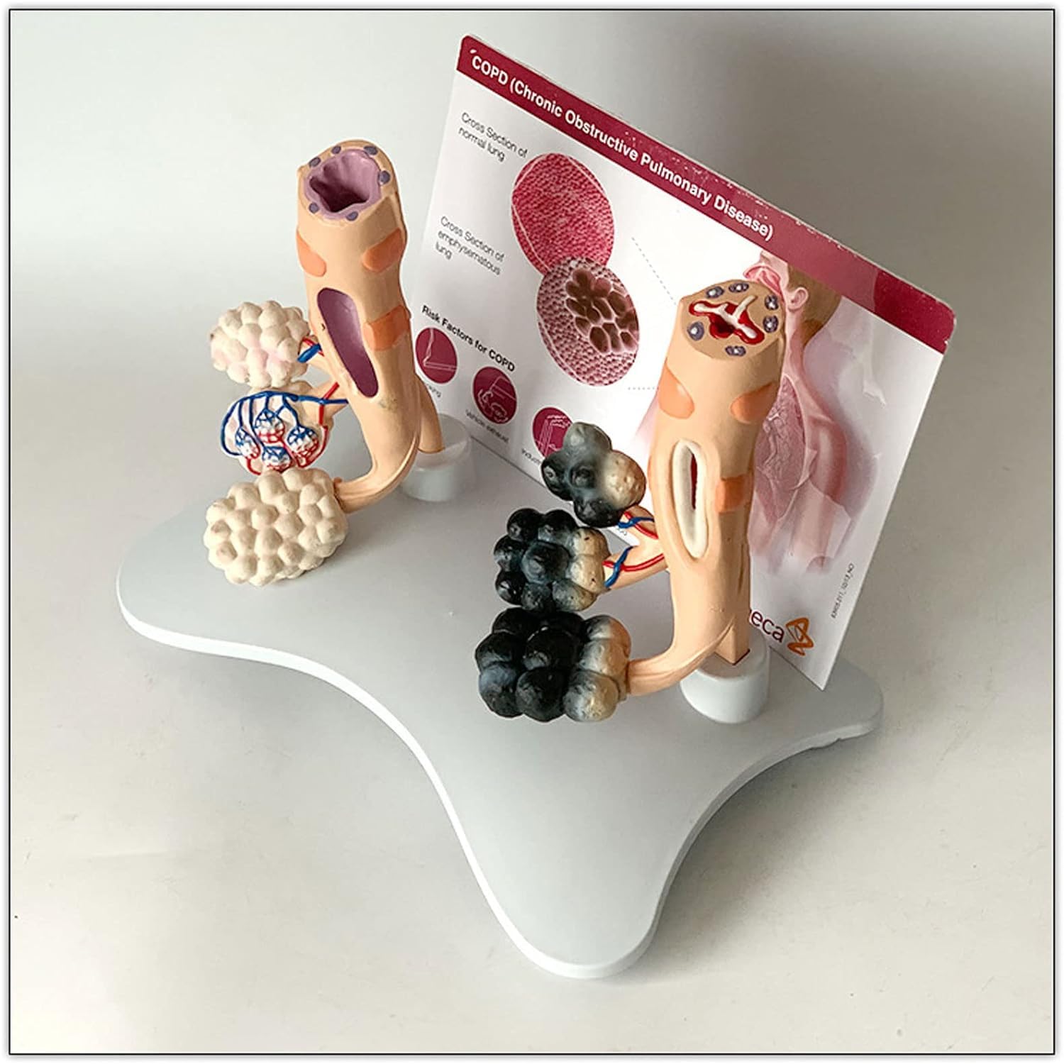 Modèle alvéolaire de la santé pulmonaire chez le fumeur, modèle de poumon sain, avec caractéristiques pathologiques et structure anatomique précise pour les effets du tabagisme sur la santé pulmonaire