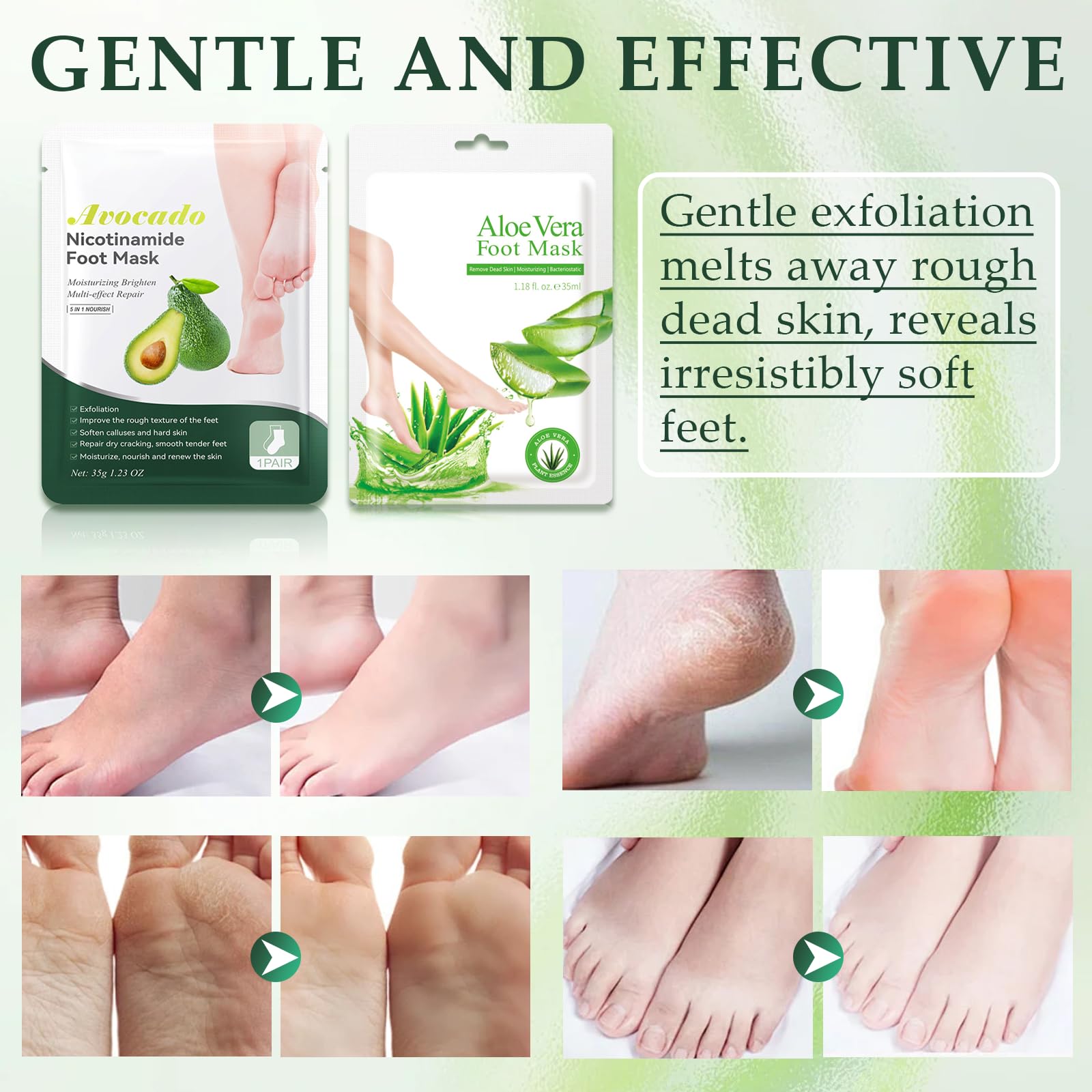 2 Paia Maschera Piedi Idratante, Esfoliante Dolce per Calli e Pelle Morta, Trattamento Quotidiano per Piedi Secchi e Screpolati, per Piedi Sempre Lisci e Morbidi (Aloe Vera e Avocado)