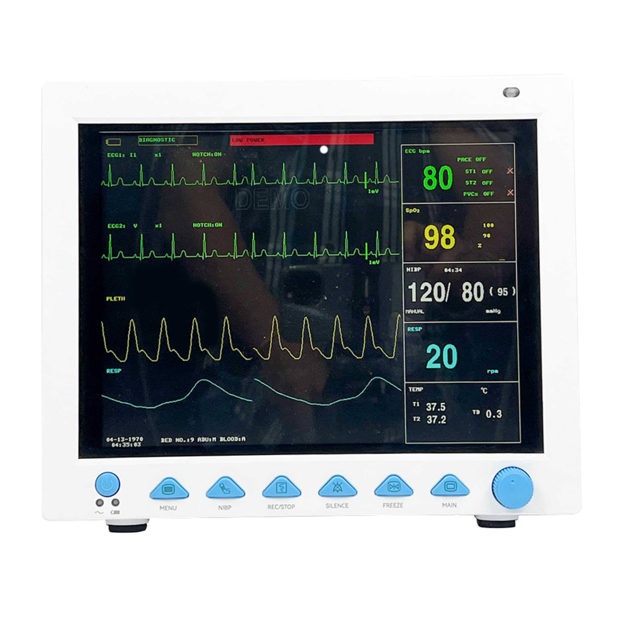 Dr Diaz Contec 5 para Patient Monitor CMS 8000 | ECG, SpO2, NIBP, Respiration, Temperature | 12.1 Inch Real-Time Alarms | Suitable for Adult Patients | 4hrs Battery Backup | 1 Year Warranty