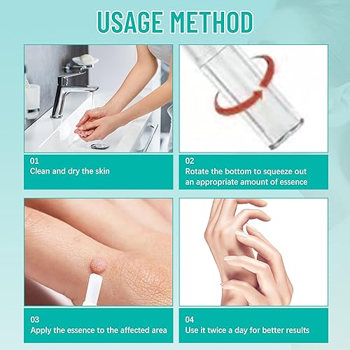 Miniatura 6 de Gonnjunm Bolígrafo para el cuidado de verrugas para manchas en la piel, 0.1 fl oz, soporte diario suave para manos, pies y dedos de los pies con