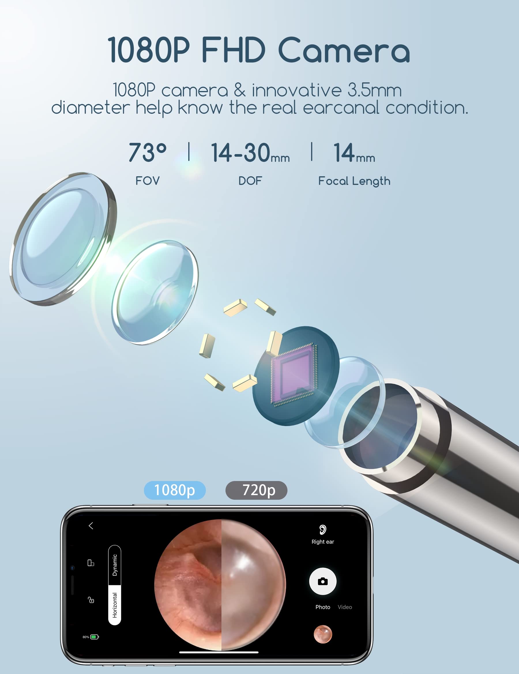 QIMIC Otoscopio, Rimozione di Cerume con Telecamera, 1080P 3,5mm Impermeabile Endoscopio con 6 Luci LED, Pulisci Orecchie per iPhone, iPad e Android