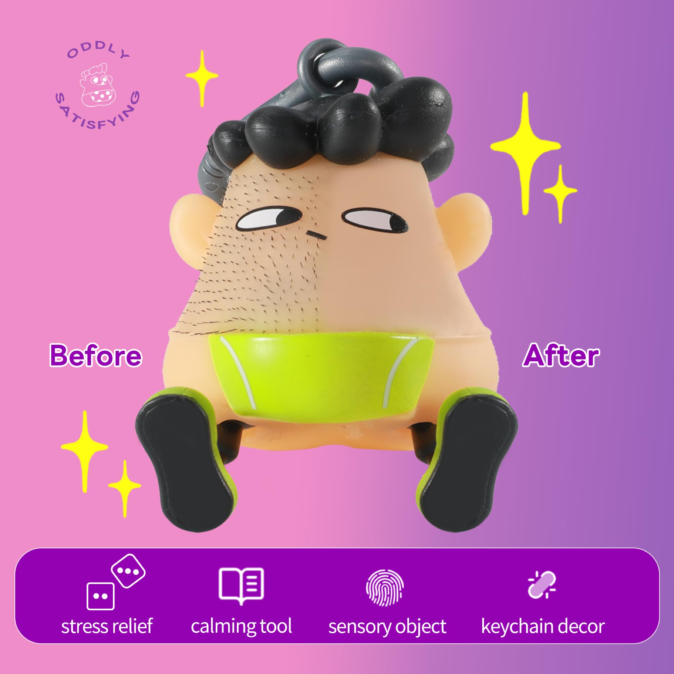 Morefol Pimple Popper Skin Picking Toy - Trichotillomania Fidget