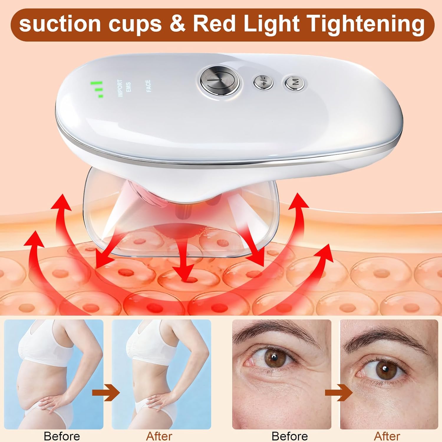 5-in-1 Electric Body Sculpting Massager - Red Blue LED Light Therapy & Microcurrent Tool with Oval/Round Suction Cups for Face & Body Tightening, Cellulite Removal, Lymphatic Drainage - Image 4