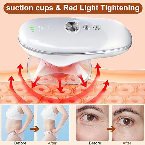 Miniatura 4 de 3-in-1 Electric Cellulite Massager & Body Sculpting Machine - 3 Adjustable Modes for Effectively Tightens The Skinat-Home Cupping Therapy Tool for