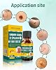 Liquid for Corn removers, Wart Remover 20ML Corn Removers for feet Extra Strength, Fast Acting Foot Corn Remover, Corn Removal for Toes, Corn Pain Remover with 15PCS Cushions 10PCS Swabs