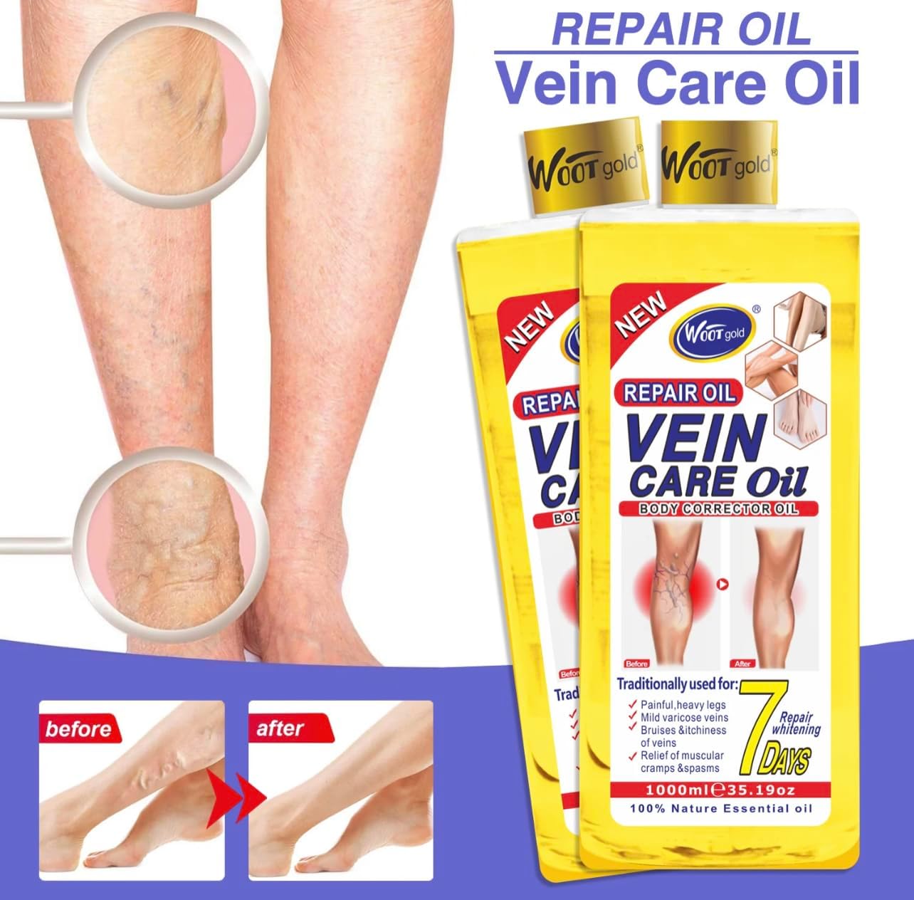 Vein Care Oil, Repair Oil for Painful Heavy Legs, Mild Varicose Veins, Bruises, Itchiness, Cramps, 35.19 oz