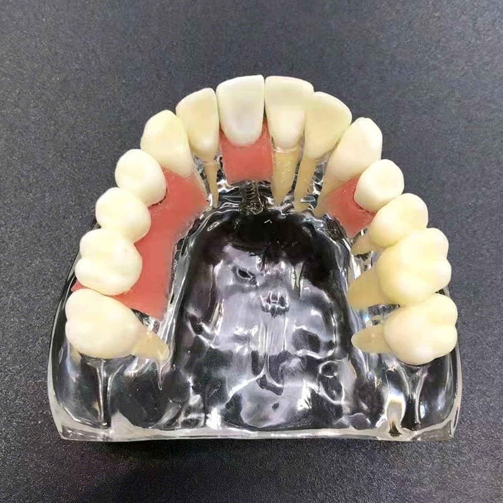 Modello di dente per restauro implantare, Dente Morbido e Bendable Modello dentali superiori con 4 denti superiori, dimostrazione con visione trasparente per studenti di odontoiatria e formazion