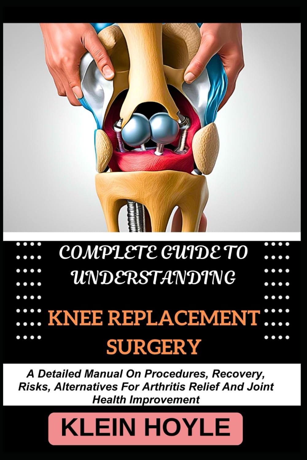 COMPLETE GUIDE TO UNDERSTANDING KNEE REPLACEMENT SURGERY: A Detailed Manual On Procedures, Recovery, Risks, Alternatives For Arthritis Relief And Joint Health Improvement