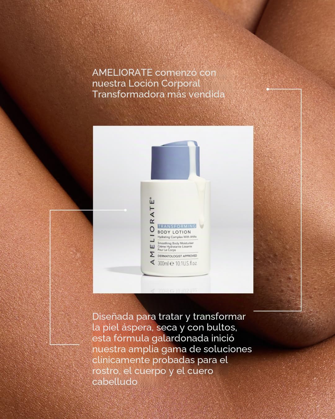 AMELIORATE Transforming Tinted Body Lotion Glow 500ml Keratosis Pilaris KP | Daily Moisturiser, Lactic Acid AHA, Strawberry Skin, Helps Remove Dead Skin Cells, Smoothes Bumps & Ingrown Hairs, Rough Dry