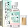 Acne Treatment Serum, Powerful Spot Treatment for Face, Drying Lotion, Face Serum for Acne and Blemishes, Reduces Excess Oil, Especially for Acne Prone and Oily Skin