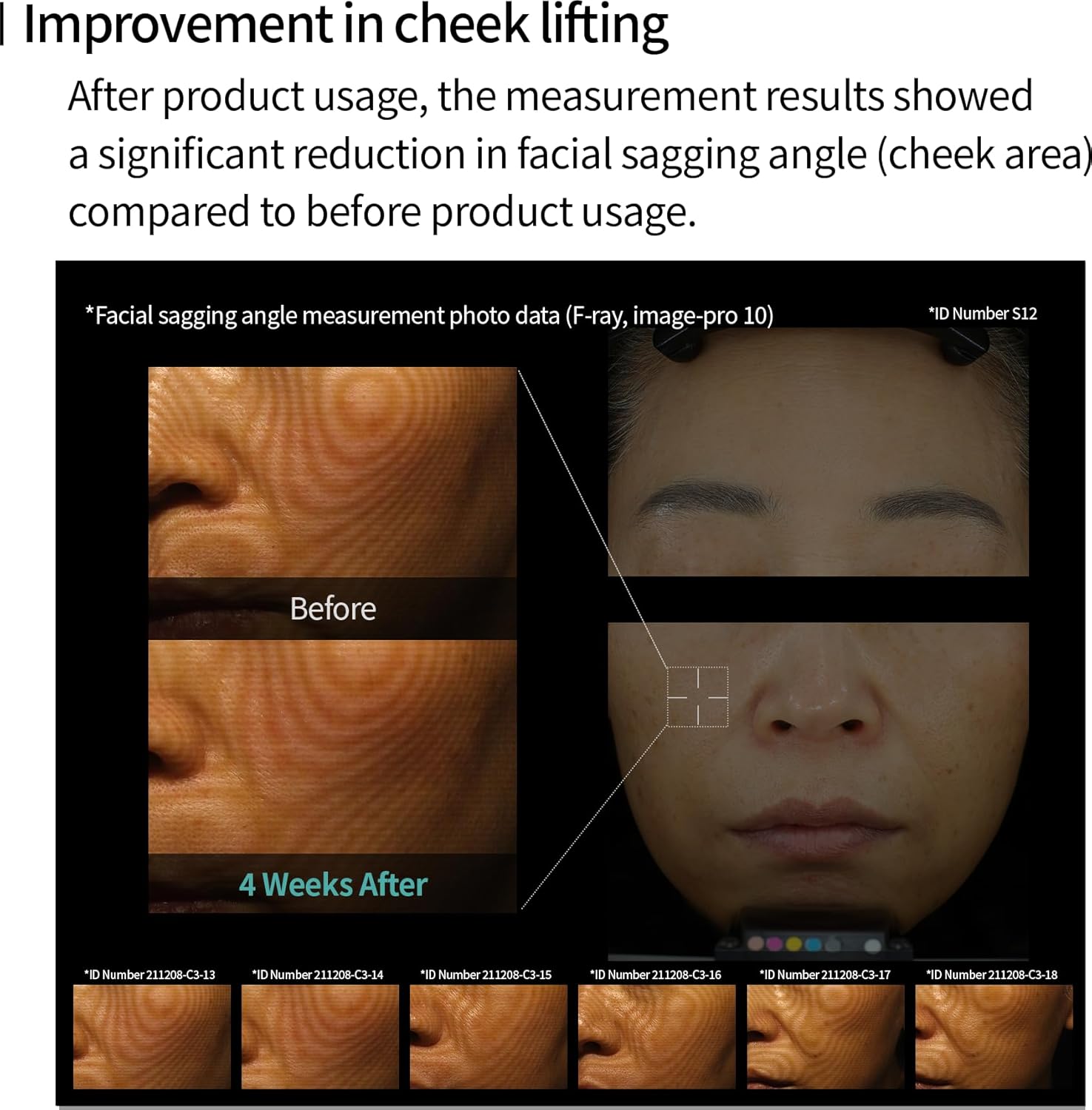 Genabelle Edelweiss Lifting Serum – Anti-Aging Formula with Edelweiss Extract, Niacinamide, Peptides for Firming, Hydration & Brightening – 1.35 fl.oz