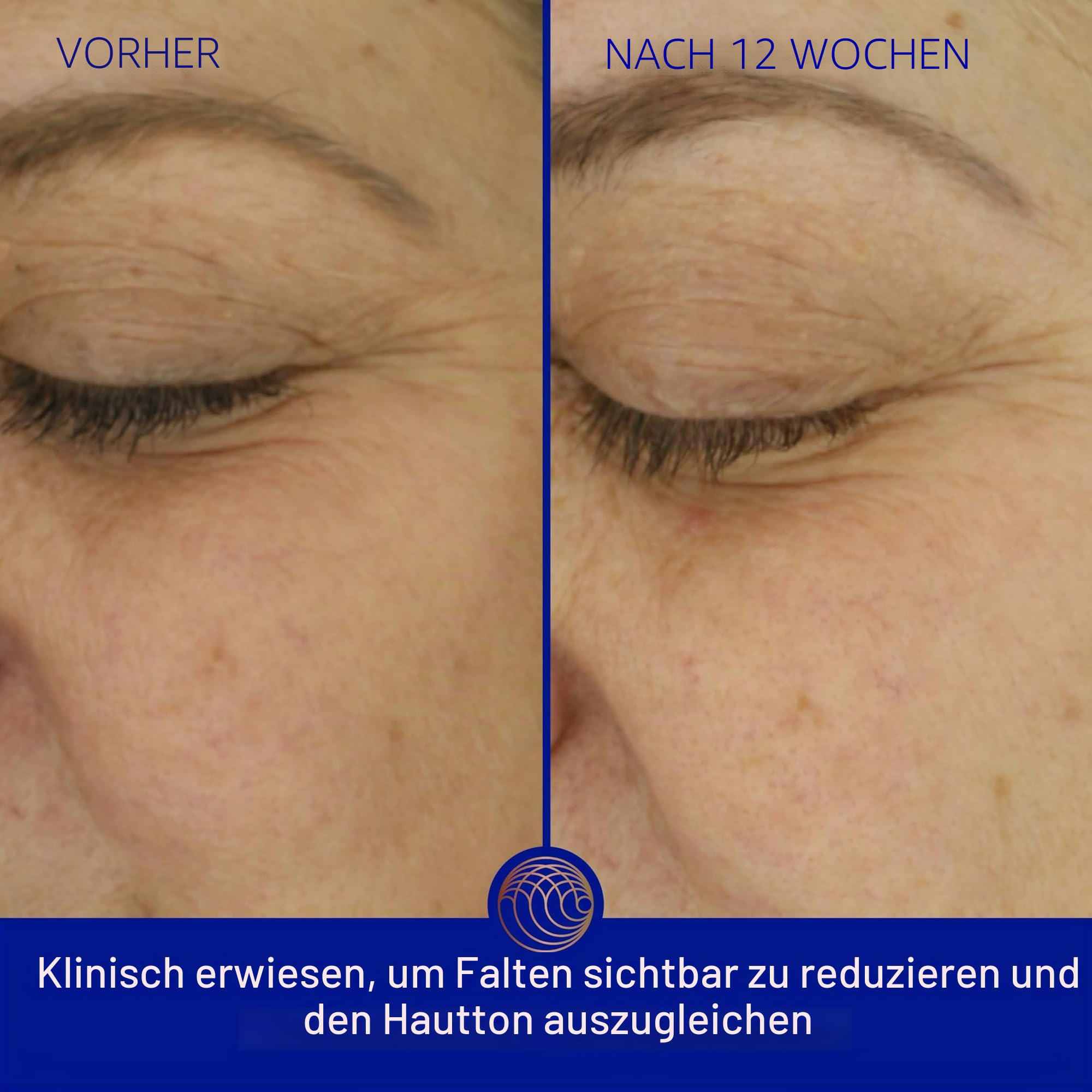 Augustinus Bader The Light Cream (30ml)