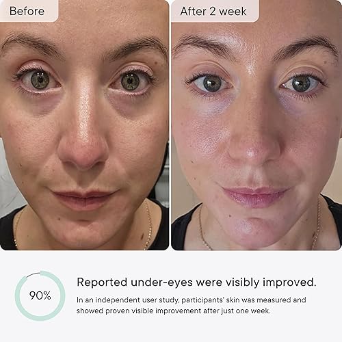 Miniatura 5 de Qure - Parches de microinfusión antiarrugas para líneas de sonrisa, líneas de ceño fruncido, bolsas debajo de los ojos, hinchazón, patas de gallo -