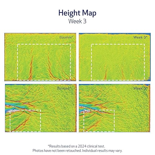Miniatura 9 de Obagi ELASTIderm Lift Up & Sculpt - Crema facial antienvejecimiento clínicamente probada que reafirma y esculpe visiblemente los contornos faciales,