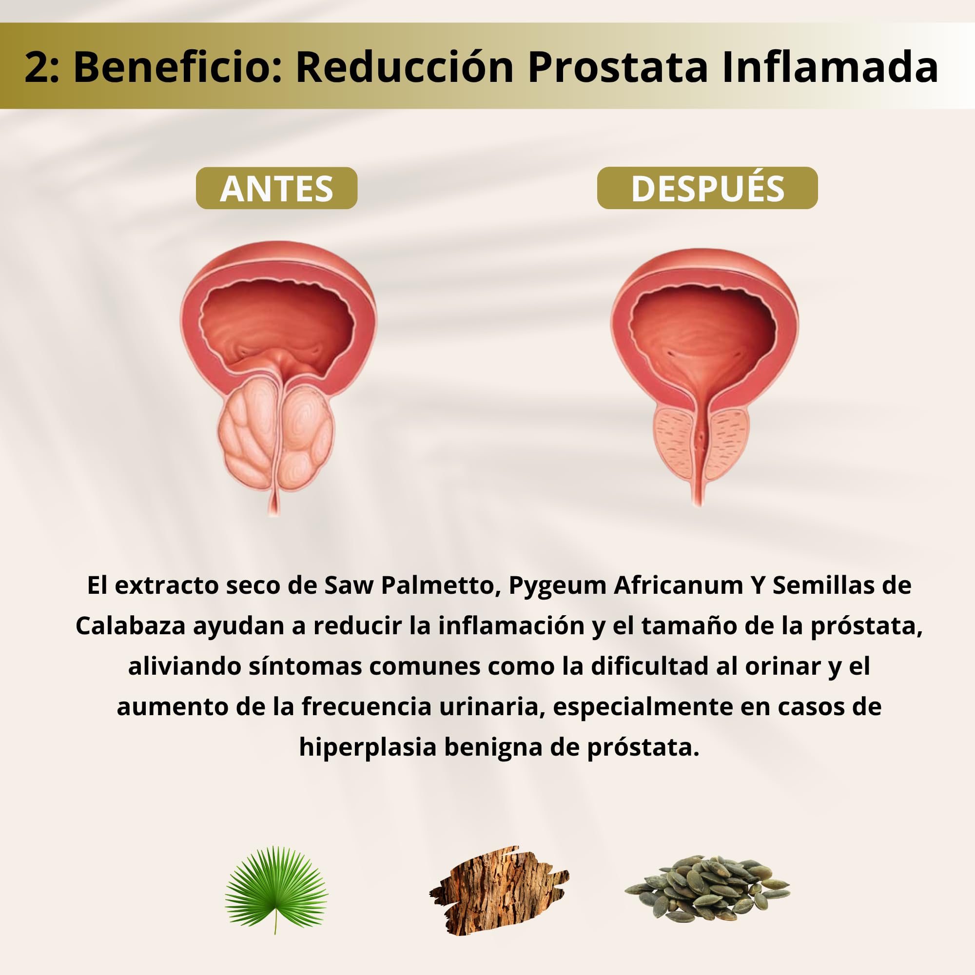 Saw Palmetto 10.500 Mg Próstata Inflamada con Serenoa Repens, Pygeum Africanum, Q10, Maca y Tribulus – Tratamiento Natural - 60 Cápsulas Vegetales para Control Urinario + Antioxidantes – Prostento