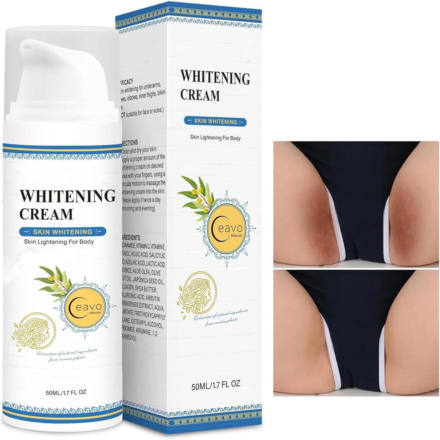 Skin Whitening Cream Bleaching Cream for Body Intimate Area, Private Parts, Underarm, Knees, Elbows, Inner Thigh, Bikini Areas, Bikini Line, Lightening Dark Spot Remover For Intimate Part (1.7FL OZ)