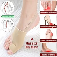 Vista 2 de Tondiamo 4 pares de almohadillas de alivio de juanetes, corrector de juanetes, férula ortopédica, calcetines correctores de juanetes, protector