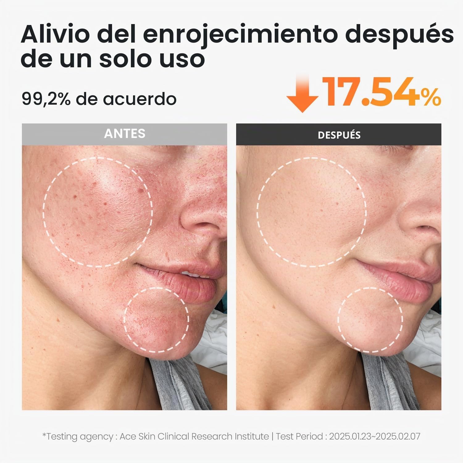 SKIN FOOD since 1957 Almohadilla de agua calmante de zanahoria caroteno 250 g (8.81 oz.) 60 hojas - Alivio del enrojecimiento Almohadillas de algodón faciales calmantes para pieles sensibles