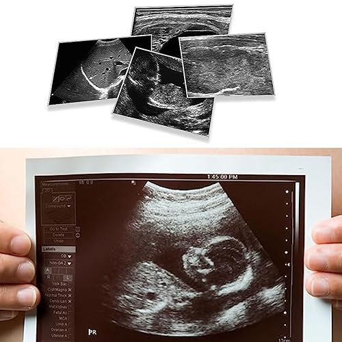 Miniatura 7 de UPP-110HG (alto brillo) compatible con Sony, papel de ultrasonido tipo V 110 películasmedios, 4.331 in x 59.1 ft, 10 rollos