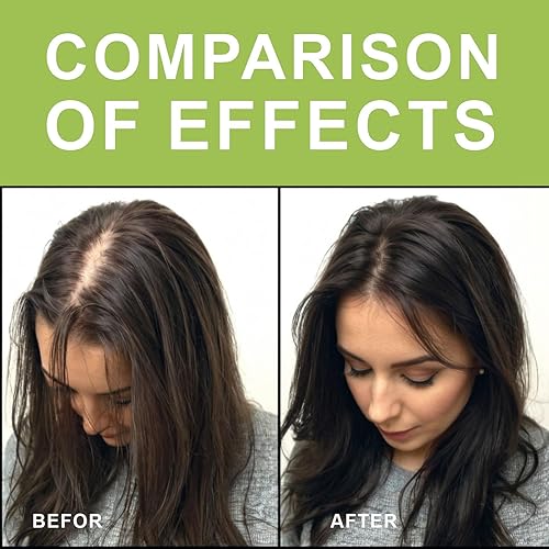 Miniatura 4 de Jabón de romero para el crecimiento del cabello, 2 barras de jabón de champú de romero, fortalece las raíces del cabello, repara el cabello dañado,