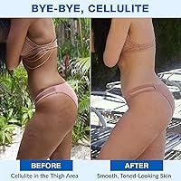 Vista 4 de Lure Essentials Sculpt Silicone ahuecamiento Theapy Set Anti Celulitis Copa Massager, succión al vacío para drenaje linfático