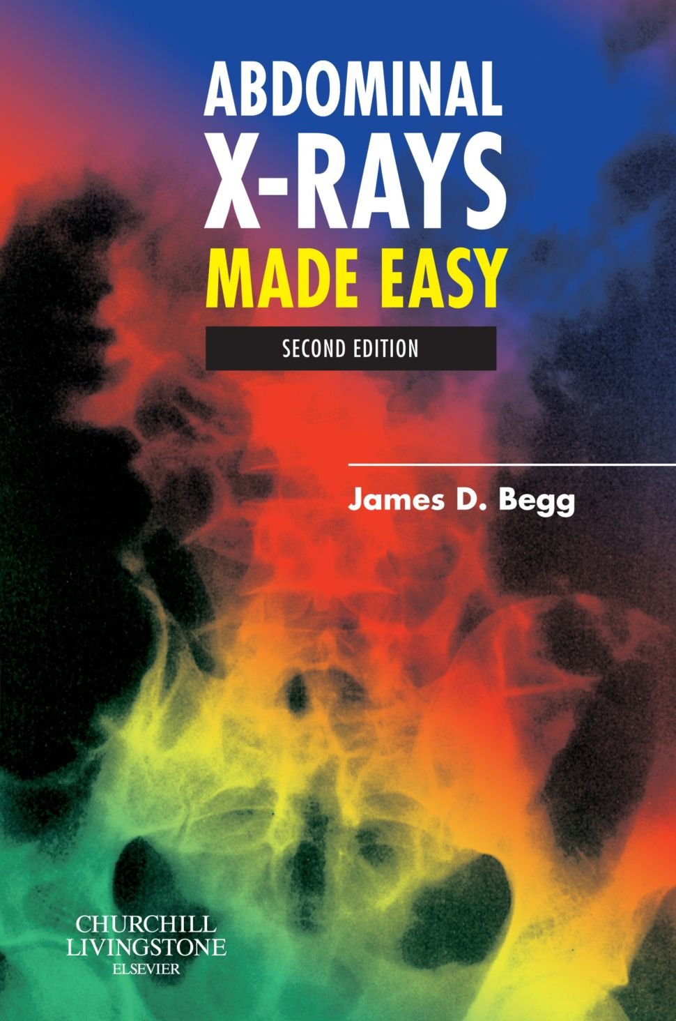 ABDOMINAL X-RAYS MADE EASY - SECOND EDITION - Very  Good / clean Cond