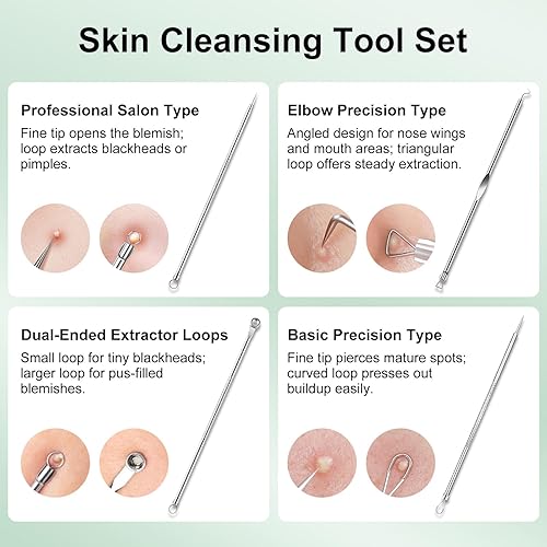 Miniatura 5 de Juego de herramientas para eliminar puntos negros con espátula limpiadora de poros, limpiador facial de silicona y 4 herramientas extractoras de