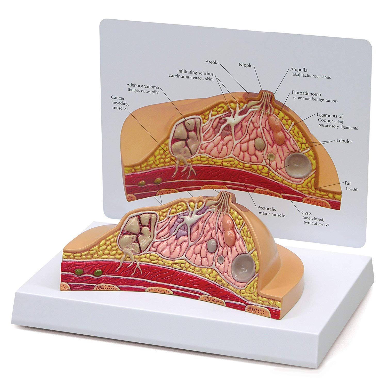 Buy GaoF Anatomy Models, Female Anatomy Mode, CrossSection Model