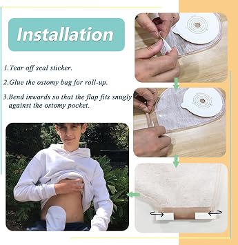 Ostomy Bag Closure Clips, Drainable Pouch Clamp Replacement, 10 Pcs