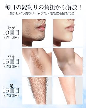 脱毛器 Air3 脇 腕 脚 髭 VIO対応 痛みレス サロン級サファイア冷感 Amazon | Ulike 脱毛器 Air3 脇 腕 脚 髭 VIO対応 メーカー2年