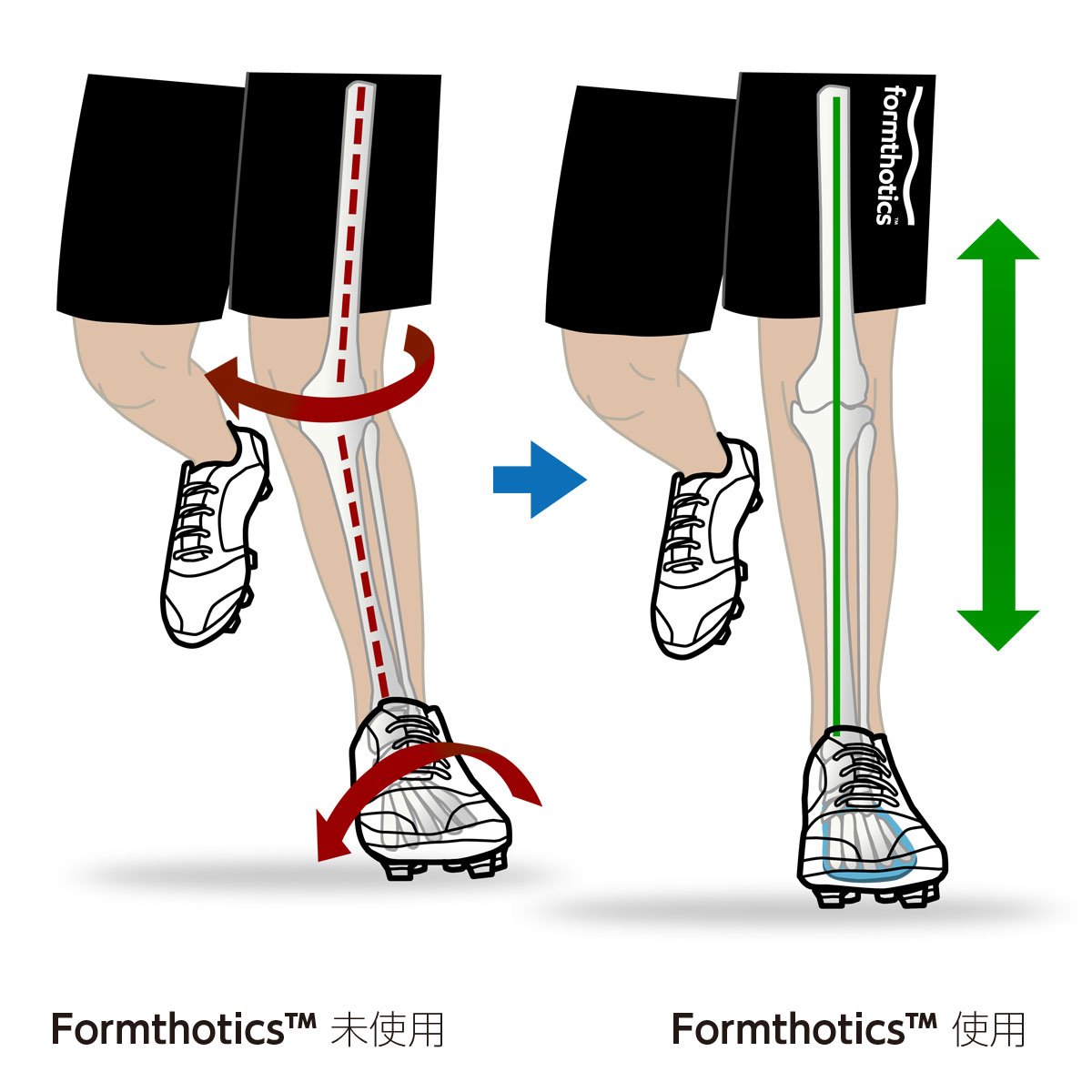 Formthotics XS、XXSセット　ピンクインソール Formthotics XS、XXSセット ピンクインソール フォームソ