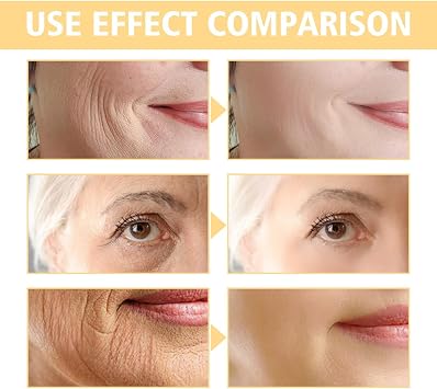 Skips The Line Instant Wrinkle Eraser Face Cream, Tightening Skin Elasticity Cream, Deep Nourishing & Repairing, Fade Fine Lines For Face And Body (3)