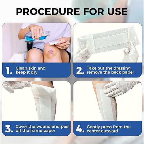 Miniatura 3 de Island Dressing - Gasa con bordes de 4 x 10 pulgadas, 50 almohadillas antiadherentes empaquetadas individualmente en el centro con borde adhesivo,