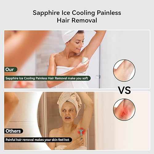 Miniatura 4 de X PRO - Depilación IPL para mujeres y hombres, sistema de enfriamiento de zafiro 21J, dispositivo de eliminación de vello permanente con destellos