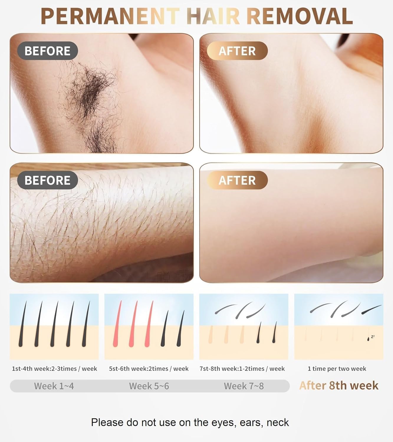 Amazon.com : Laser Hair Removal Device IPL Hair Removal Permanent