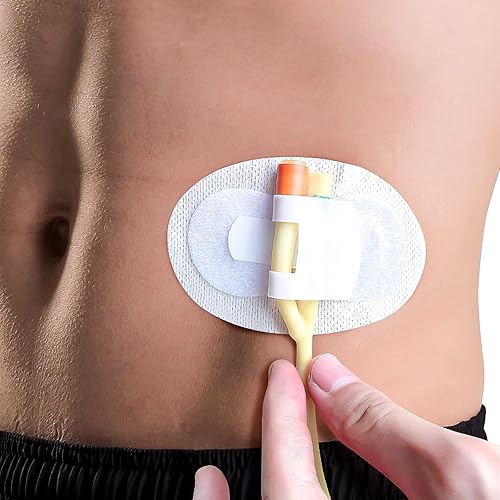 Miniatura 6 de Soporte para bolsa de catéter, soporte de banda para piernas de catéter, etiqueta engomada de fijación de tubo urinario, soporte de tubo de catéter,