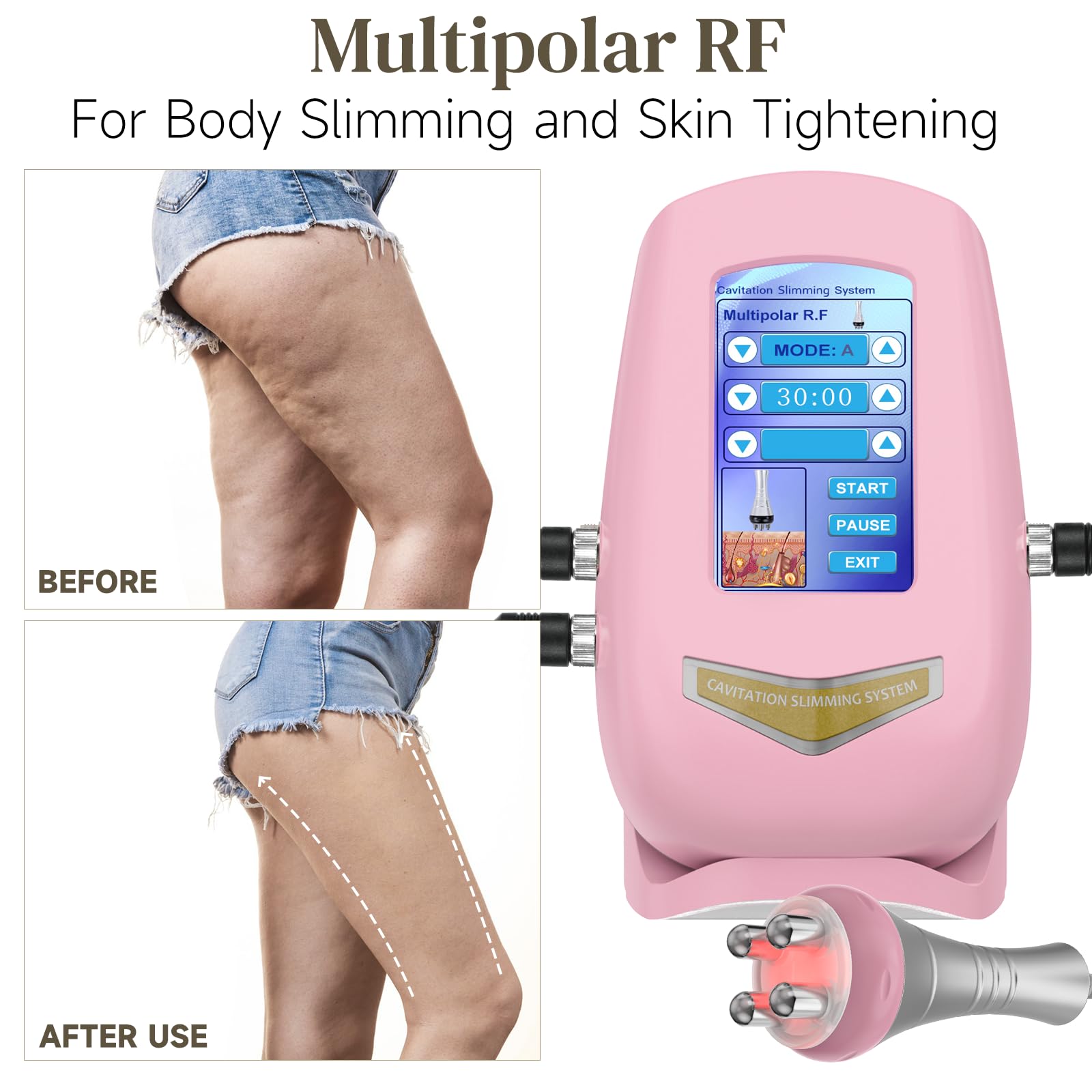 Durskfl Radiofrequenza Viso e Corpo 40K Massaggiatore Anticellulite, 3 In 1 Anticellulite Macchinario Cavitazione Vacuum Cellulite massaggiatore Radiofrequenza corpo Rassodanti e Tonificanti (M)