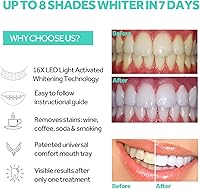 Vista 3 de Teeth Whitening Accelerator Light, 16x More Powerful Blue LED Light, Mouth Tray Teeth Whitening Enhancer Light Trays Connected with