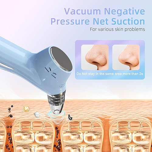 Miniatura 2 de Removedor de puntos negros, aspiradora facial, limpiador de poros eléctricos, comedones, 5 sondas de succión y 5 niveles de succión, herramientas