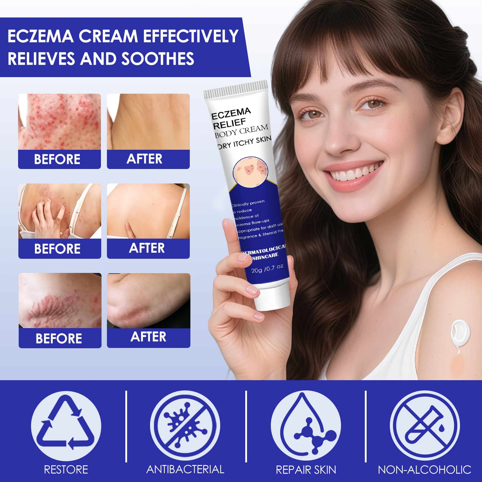 20g Crema per Eczema,Crema Corpo Lenitiva,crema Idratante,efficacemente Nutre la Pelle Secca,Adatta a Viso e Corpo