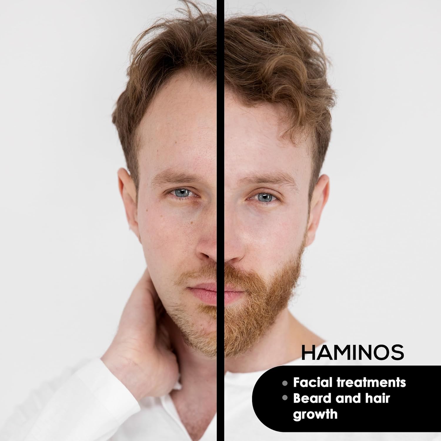 Head 0.25 mm compatible with Haminos Derma Roller, 105 Titanium Needles - Image 5