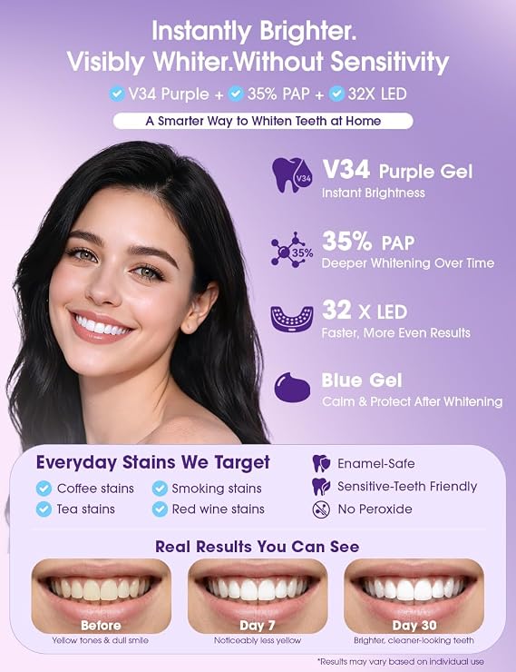 Teeth Whitening Kit with LED Light 35% Pap + Purple Tone Neutralizing 3 Whitening Pens + 2 Desensitising Gel Pens Instant Brightness & 7-Day Whitening Enamel-Safe