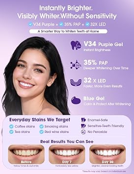 Teeth Whitening Kit with LED Light 35% Pap + Purple Tone Neutralizing 3 Whitening Pens + 2 Desensitising Gel Pens Instant Brightness & 7-Day Whitening Enamel-Safe