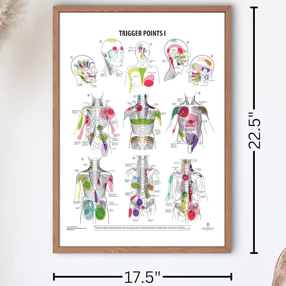Anatomy Lab Trigger Points I Laminated Poster | 17.3 x 22.5 Inch Detailed Anatomy & Physiology Chart of Muscle Trigger Points for Study, Classroom
