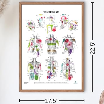 Anatomy Lab Trigger Points I Laminated Poster | 17.3 x 22.5 Inch Detailed Anatomy & Physiology Chart of Muscle Trigger Points for Study, Classroom