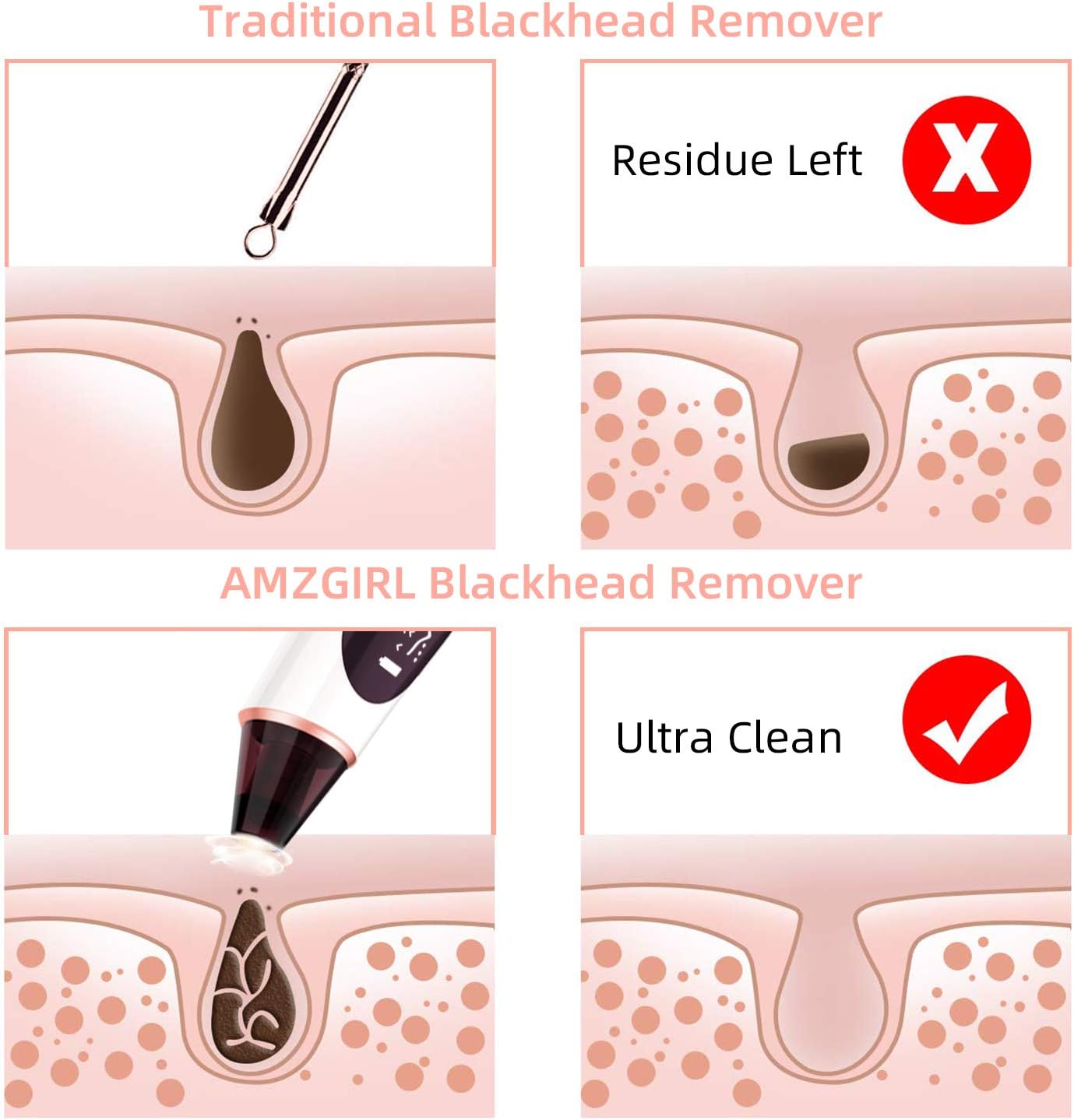 Blackhead Remover, Pore Vacuum with Camera,Acne Extractor - Blackhead Cleaner with 4 Probes and 3 Adjustable Strength Power,USB Rechargeable for All Skin : Beauty & Personal Care