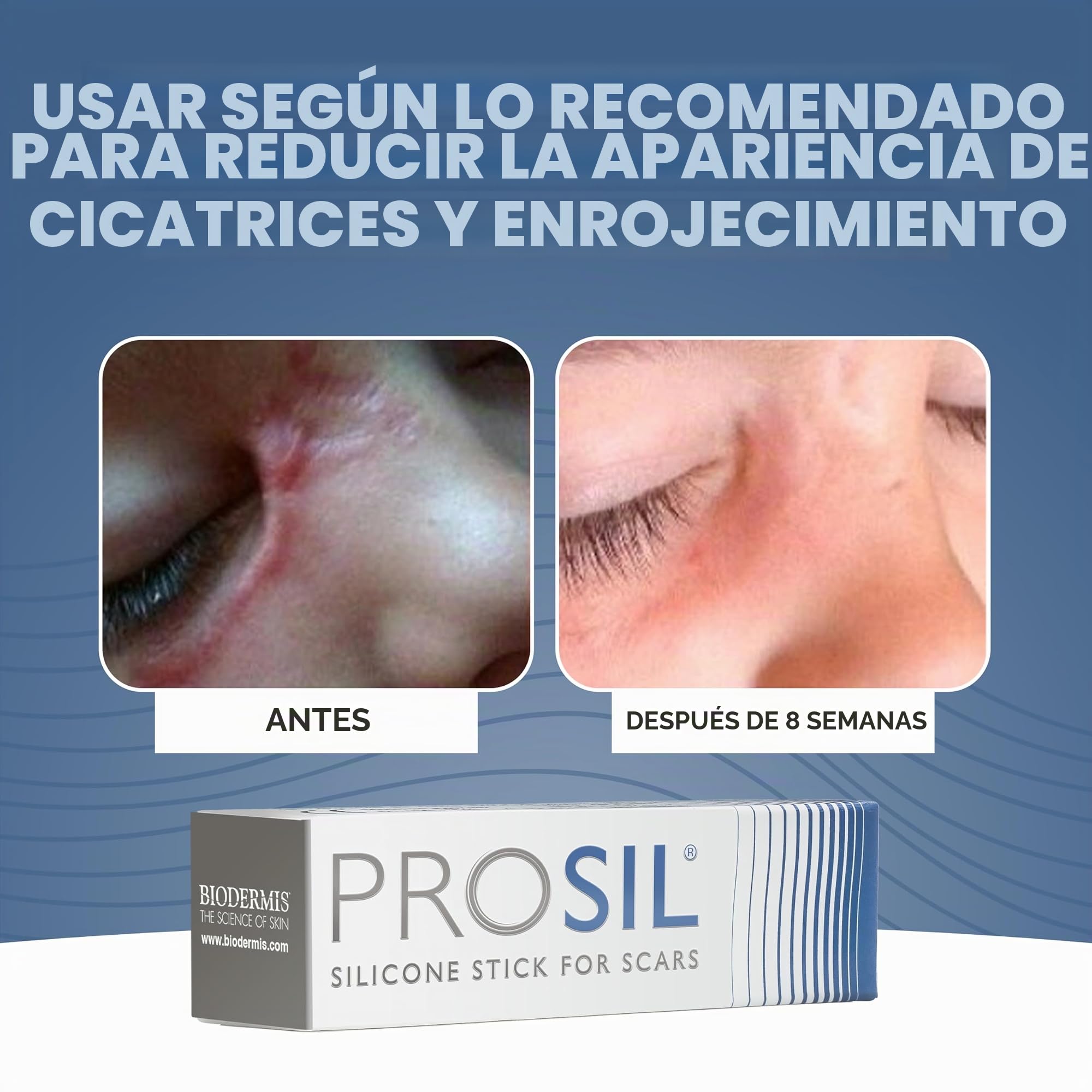 BIODERMIS - Stick de Silicona para Cuidado de Cicatrices | Ayuda con Cicatrices y Queloides | Ideal para Uso Diario | Fácil Aplicación, 17 g, Paquete de 1